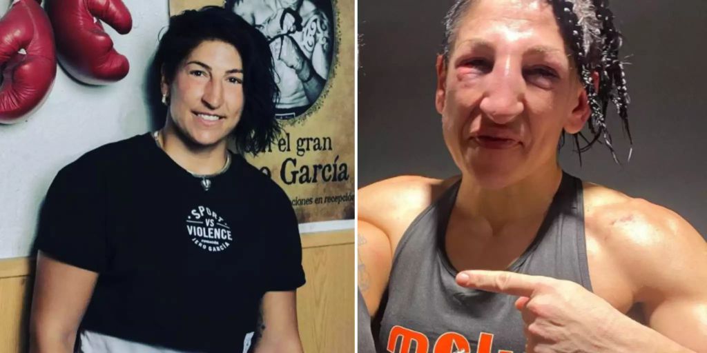 Miriam Gutierrez Gesicht von ProfiBoxerin nach Kampf entstellt