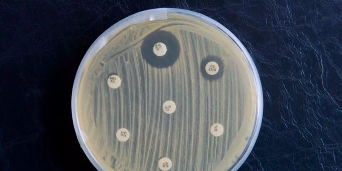 Mehrfach-resistente Keime in einer Petri-Schale. Die weissen Plättchen geben verschiedene Antibiotika ab, von denen nur noch wenige die Keime im Umkreis absterben lassen. Antibiotikaresistenz