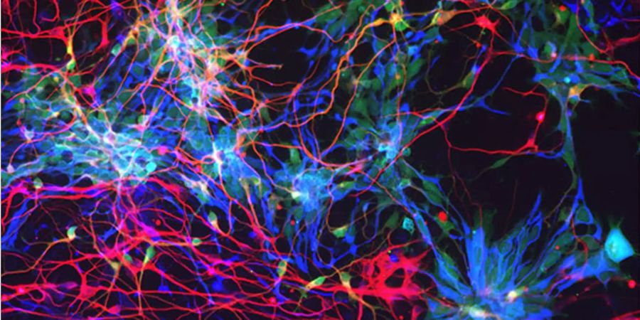 Diese Grafik zeigt menschliche kortikale Zellen in vitro 2. Zwei Forschergruppen haben eine Antwort auf die Frage gefunden, weshalb das Gehirn des Menschen etwa dreimal so gross ist wie das seiner nächsten Verwandten im Tierreich.