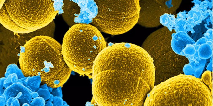 Das Bakterium Stapholycoccus aureus (gelb eingefärbt) ist multiresistent. Das bedeutet, es ist gegen viele Antibiotika resistent. (Archivbild)