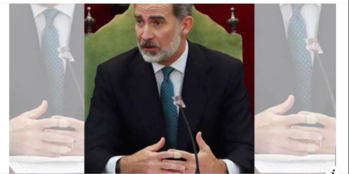 König Felipe von Spanien wird immer wieder mit Pflastern an den Fingern gesehen. felipe