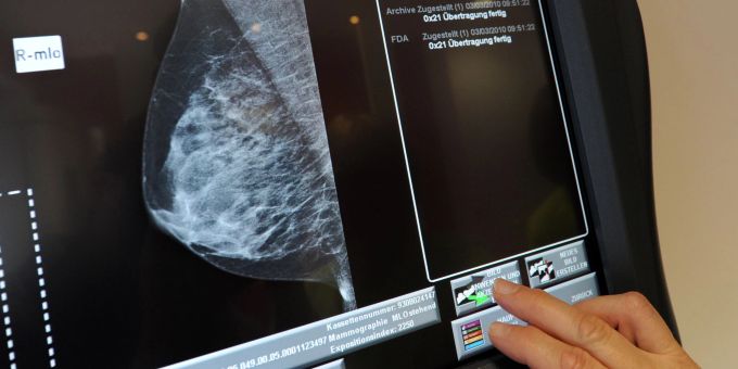 Bei Krebsbehandlungen bestehen in spezialisierten Zentren grössere Erfolgsaussichten als in normalen Kliniken. Bei Krebsbehandlungen bestehen in spezialisierten Zentren grössere Erfolgsaussichten als in normalen Kliniken.