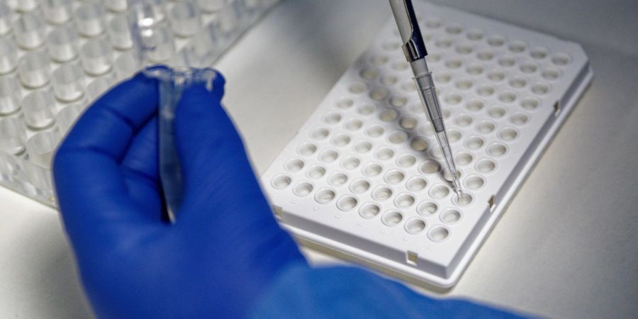 RKI-Wochenbericht: Welche Varianten sind in Deutschland vorherrschend? Welche machen besonders krank?