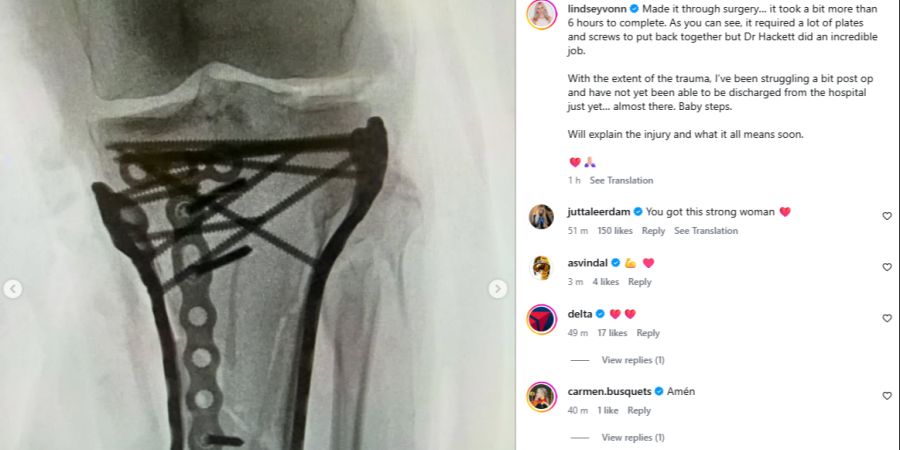 lindsey vonn olympia 2026