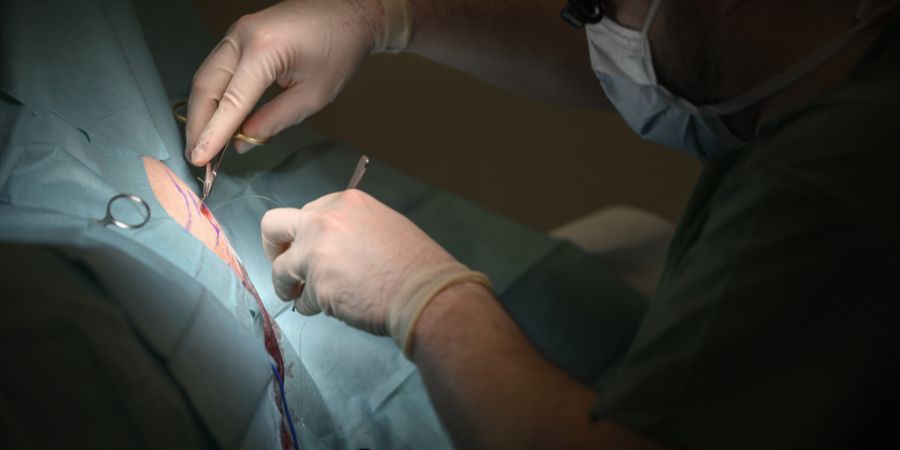 Operation