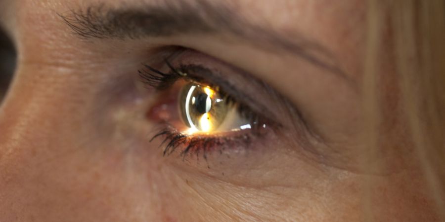 Der Kanton Basel-Stadt unterstützt weiterhin ein Forschungsprogramm zur Behandlung von Augenkrankheiten. (Symbolbild)