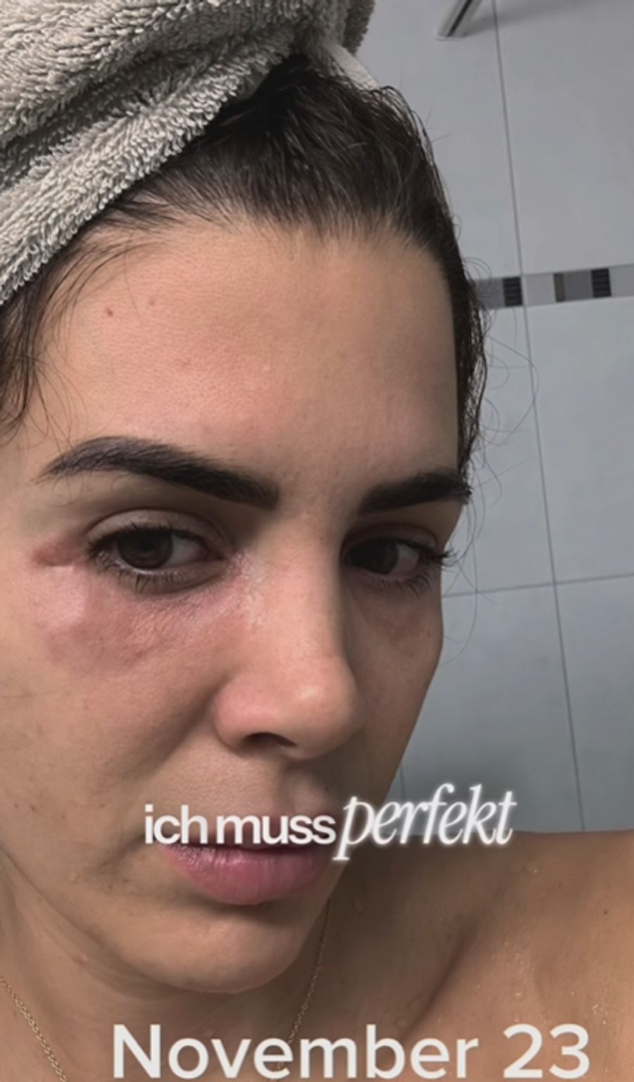 Die Zürcherin litt stark unter dem OP-Pfusch.