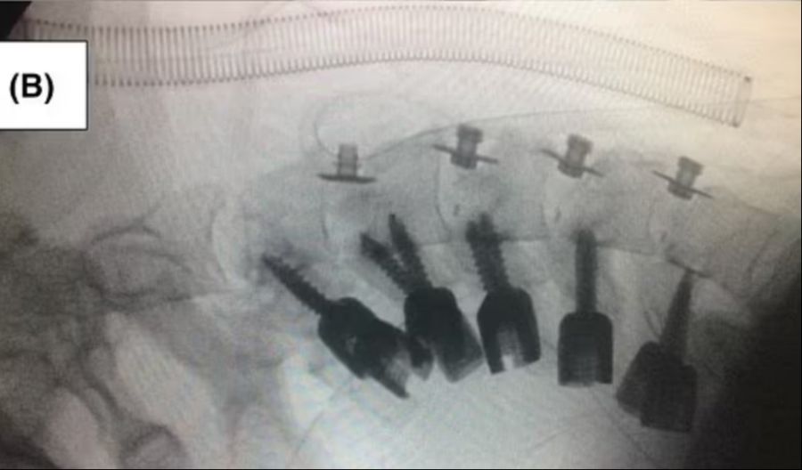 Bilder des Al-Zahra Universitätsspitals zeigen die korrigierte Stelle.