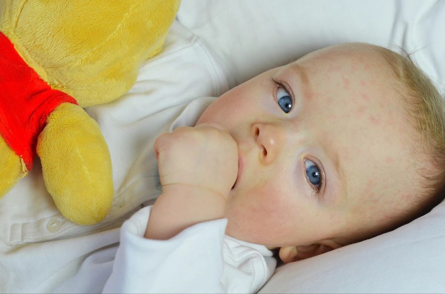 Roseola Baby Ausschlag