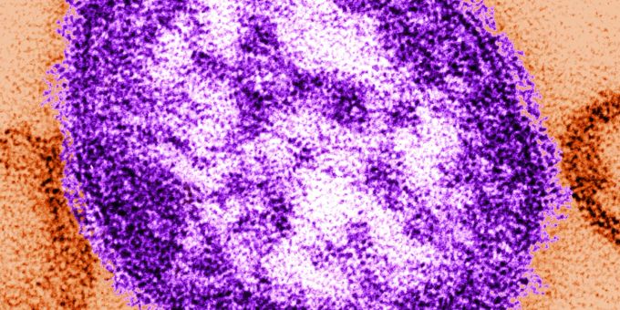 Masern sind Fachleuten zufolge weiterhin ein relevantes Problem (Archivbild). Masern sind Fachleuten zufolge weiterhin ein relevantes Problem (Archivbild).