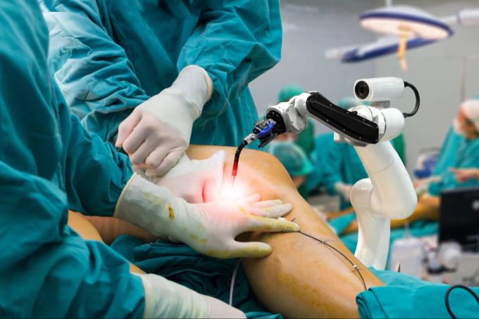 Die Roboter sollen Chirurgen dabei helfen, OPs durchzuführen, damit diese nicht so schnell ermüden. Chirurgie Roboter