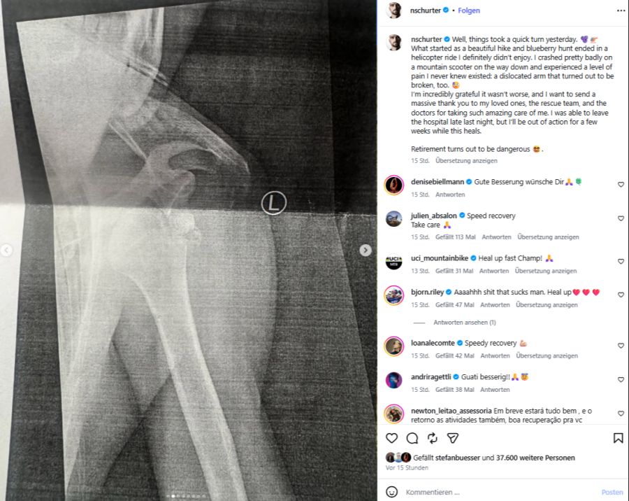 Im Spital stellt sich heraus, dass der Arm ausgekugelt und gebrochen ist.