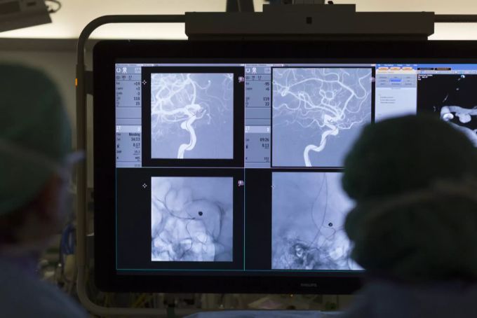 Das neue Implantat soll Betroffenen zu mehr Lebensqualität verhelfen. implantat
