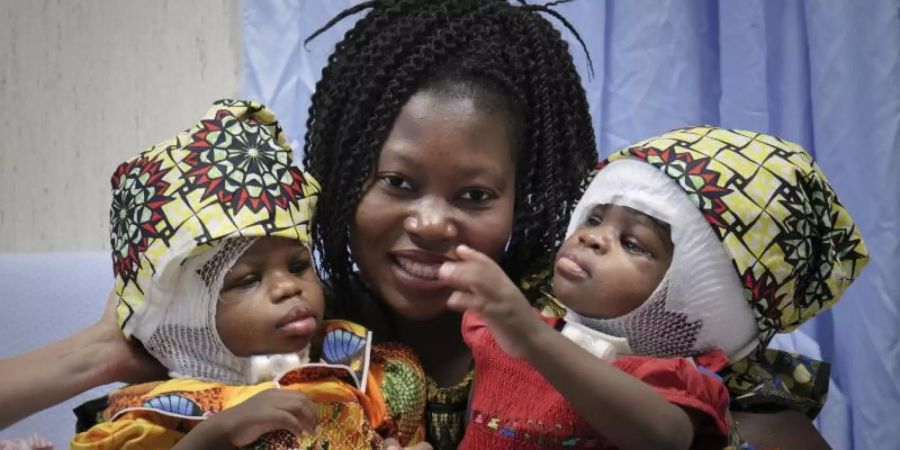 Mutter und Zwillingsmädchen nach der Operation in Rom. Foto: Ospedale Pediatrico Bambino Gesù/dpa