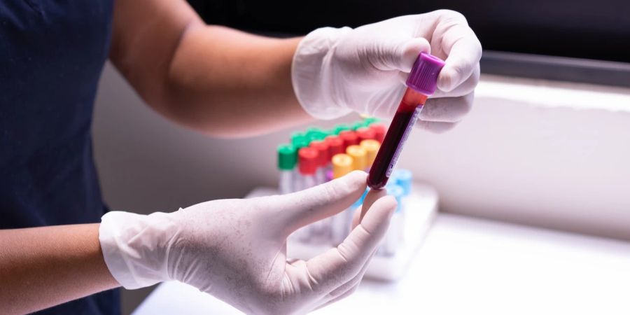 Reagenzglas Blut Hände Handschuhe Labor