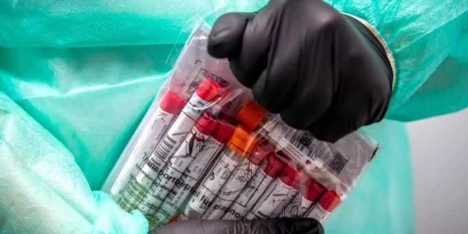 Proben für PCR-Tests werden von einem Mitarbeiter in einem Corona-Testzentrum verpackt. Foto: Sina Schuldt/dpa Proben für PCR-Tests werden von einem Mitarbeiter in einem Corona-Testzentrum verpackt. Foto: Sina Schuldt/dpa