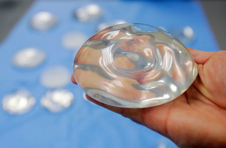 Einige Patientinnen wünschen sich nach der Gewichtsabnahme eine Bruststraffung – teilweise wird dazu auch ein Implantat eingesetzt.