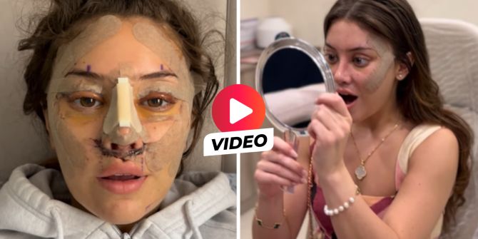 Face-Lift