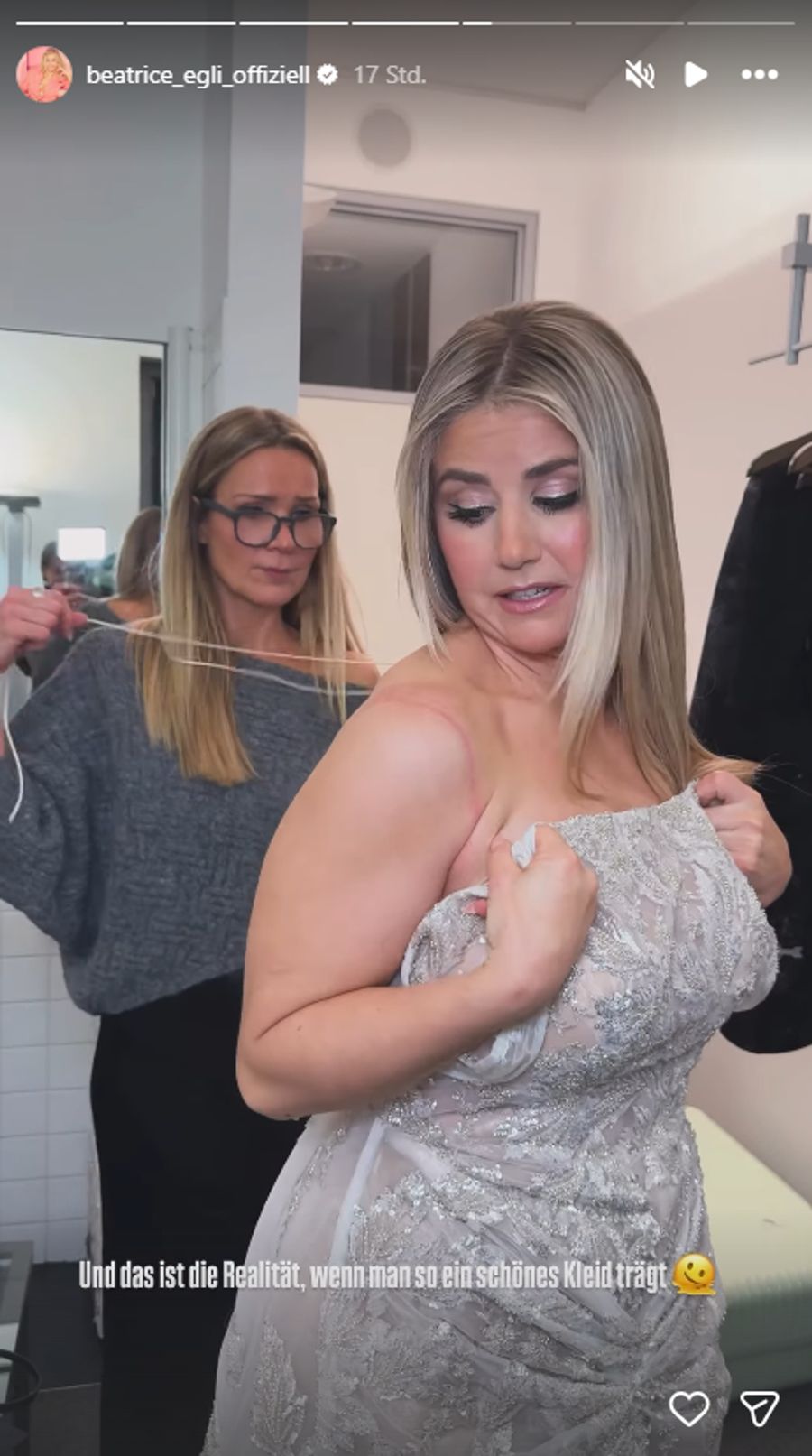 Aua! Das schöne Kleid hinterliess schmerzhafte Spuren.