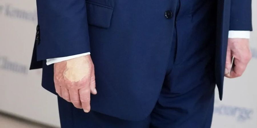 Hand