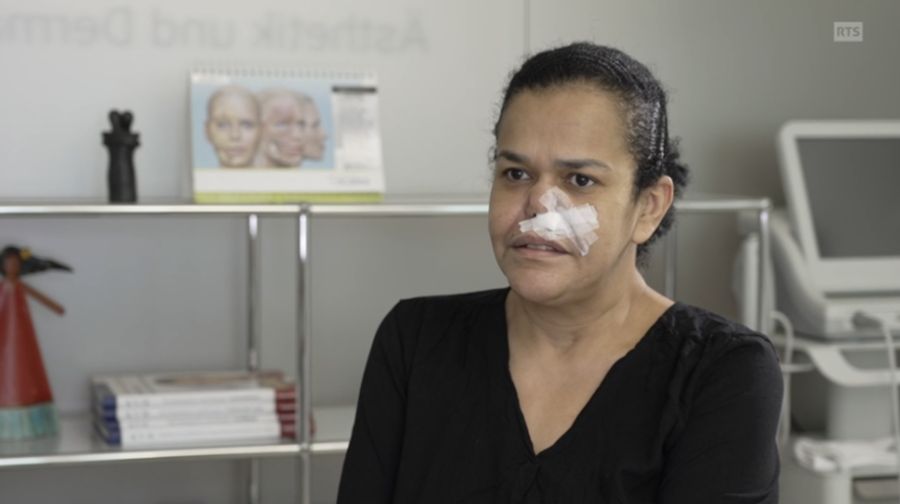 Das führte bei Daniela zu einer schweren Infektion und einem entstellten Gesicht.