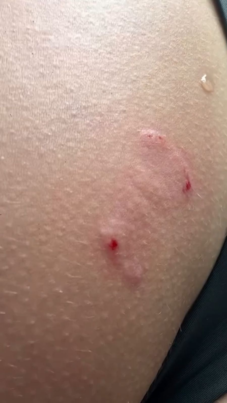 Die Influencerin teilt ein Foto des Resultats.