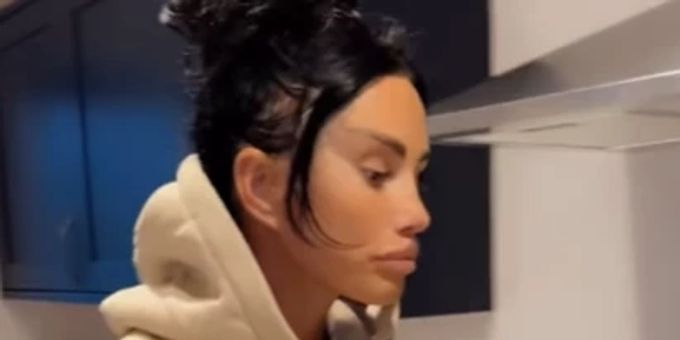 «So traurig» - Katie Price zeigt Facelift-Ergebnis – Fans entsetzt!