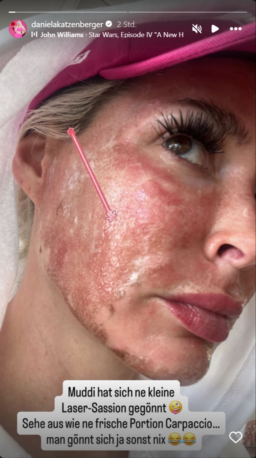 Daniela Katzenberger