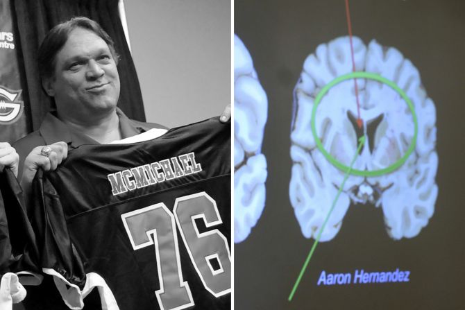 NFL Steve McMichael CTE