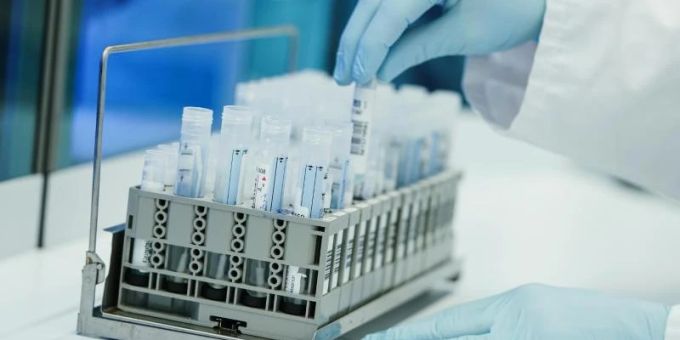 Ein Mitarbeiter hält in einem Coronatest-Labor PCR-Teströhrchen in den Händen. Foto: Uwe Anspach/dpa Ein Mitarbeiter hält in einem Coronatest-Labor PCR-Teströhrchen in den Händen. Foto: Uwe Anspach/dpa