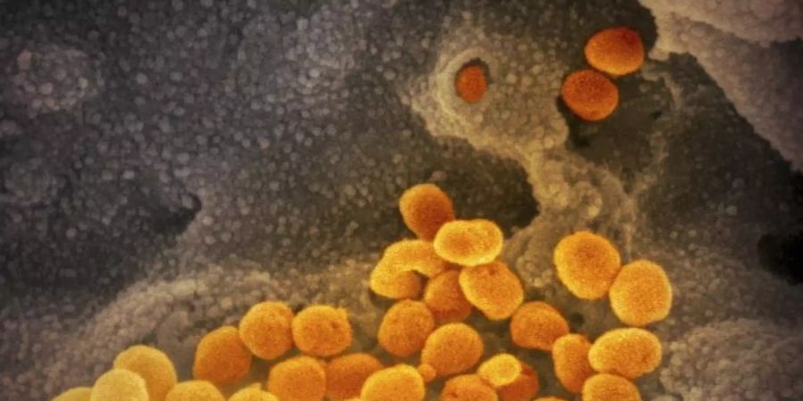 Eine undatierte elektronenmikroskopische Aufnahme des «U.S. National Institute of Health» zeigt das neuartige Coronavirus (SARS-CoV-2) (orange), das aus der Oberfläche von im Labor kultivierten Zellen (grau) austritt. Die Probe wurde von einem Patienten in den USA isoliert. Foto: NIAID-RML/AP/dpa