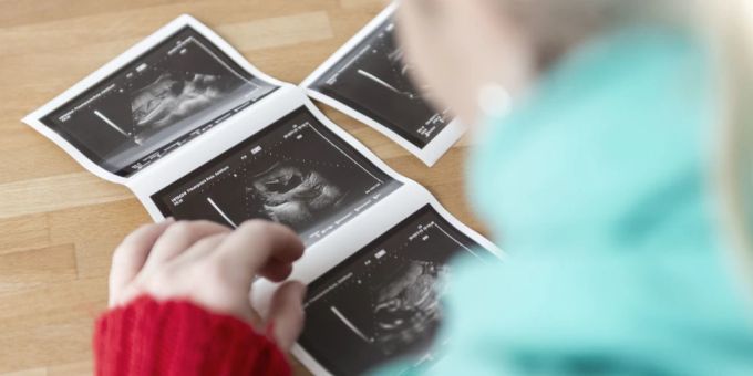 Vorbild Texas - SVP-Nationalräte erwägen Abtreibungsverbot ab 6. Woche
