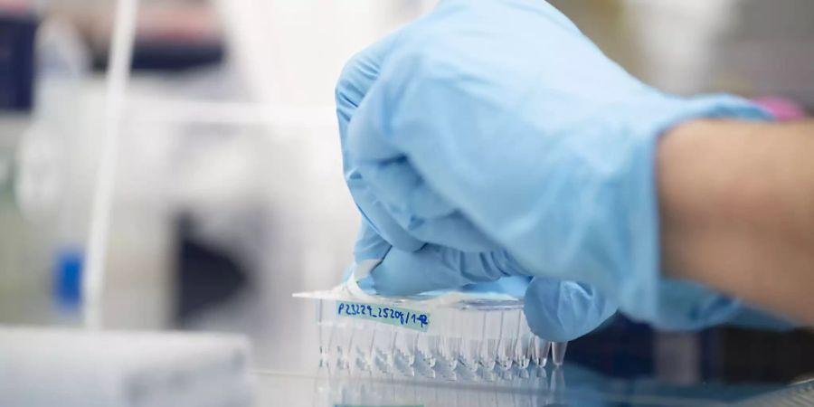 Ein Labormitarbeiter bereitet Sars-CoV-2-Proben zur Genomsequenzierung vor: Allein im August wurden schweizweit mehr als 5600 Sequenzen analysiert.