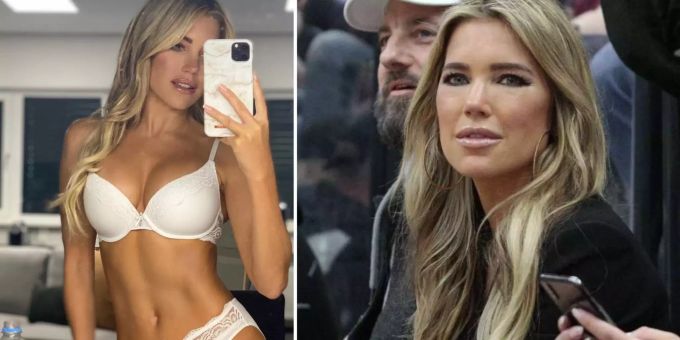 «Tabu-Ecke» - Sylvie Meis gesteht, was sie an sich hat machen lassen