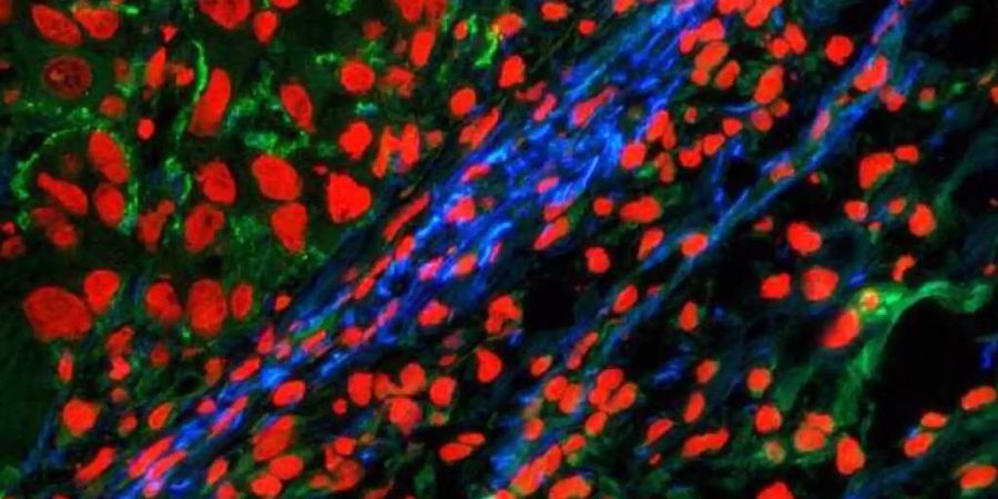 Fluoreszenzmikroskopiebild vom Tumorrand: Der Tumorrand ist mit dem neuen Marker-​Molekül blau gefärbt, oben links davon ist Tumorgewebe. Grün: Kollagen, rot: Zellkerne (ETH Zürich).