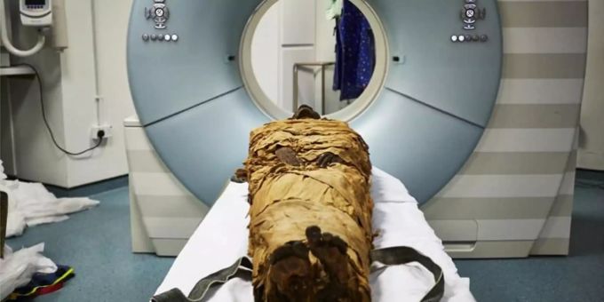 Die 3000 Jahre alte Mumie kurz vor dem CT-Scan. Mumie erhält Stimme