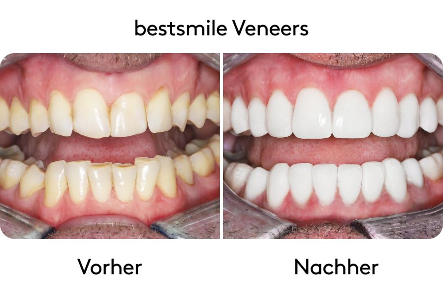 Vorher-Nachher Bilder