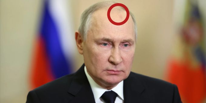 Wladimir Putin hatte bei seiner jüngsten Rede einen roten Fleck auf der Stirn - dieser sorgte einmal mehr für Gerüchte über seine Gesundheit. Wladimir Putin
