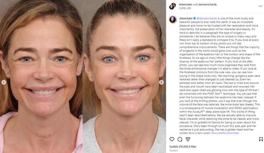 Auf Instagram erhält sie viele Komplimente.