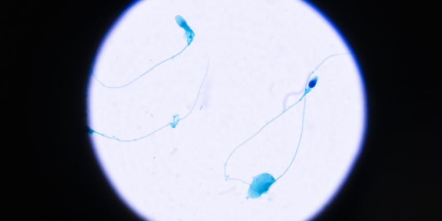 Die Spermienqualität hat nachgelassen. (Symbolbild)