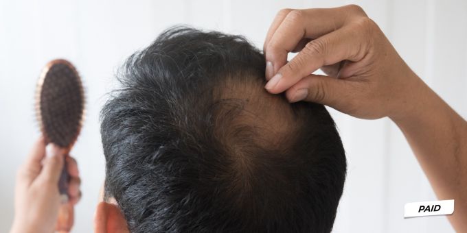 Aus der Schweiz - Haare zurück: Diese 3-in-1-Formel wirkt