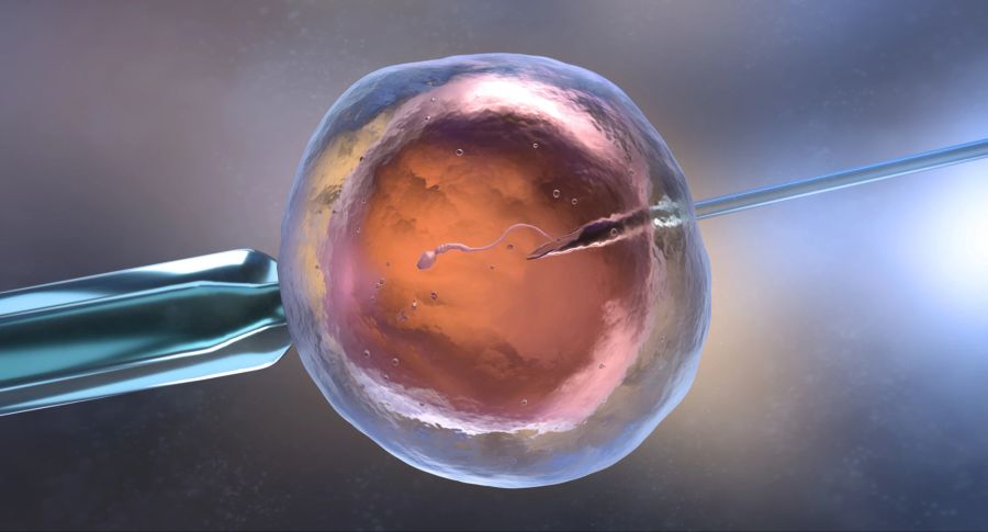 Künstliche Befruchtung oder In-vitro-Fertilisation.