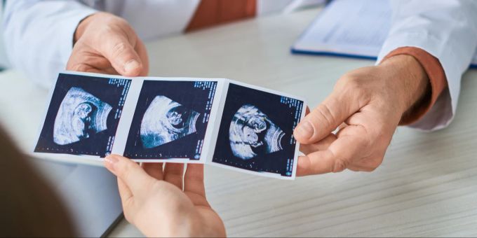 Künstliche Befruchtung mit genetischer Testung der Embryonen bietet vielen Frauen eine höhere Erfolgschance. Arzt zeigt ein Ultraschall des Babys, Konzept der In-Vitro-Methode.