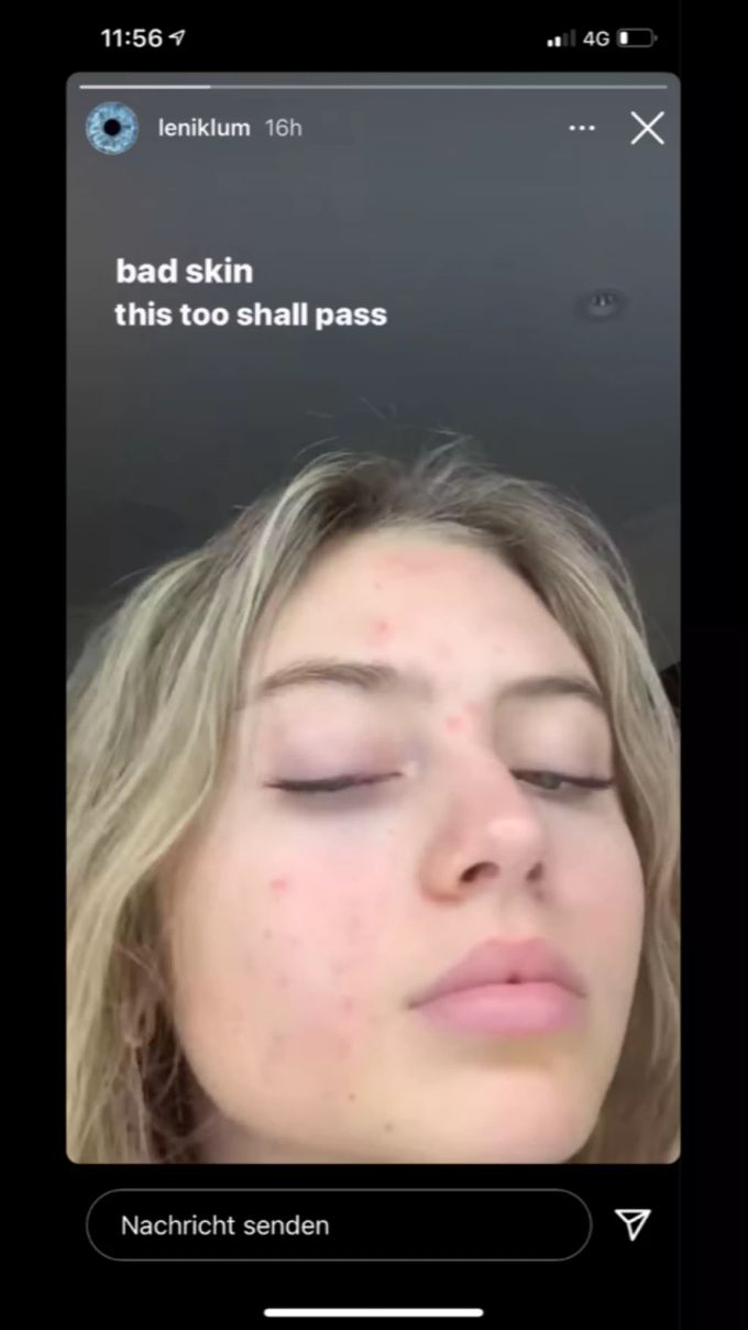 leni