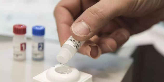 Vorurteile - Aids-Hilfe Schweiz lanciert Kampagne gegen Diskriminierung