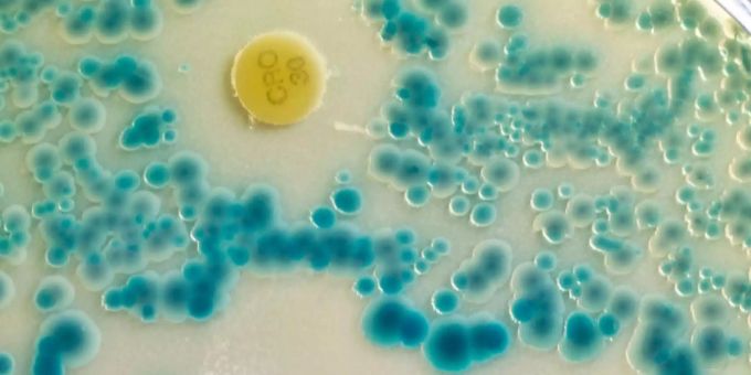 Via Wasserzerstäuber, Wellnessbäder oder öffentliche Duschen verteilen sich Bakterien, die zu tödlichen Lungenkrankheiten führen können. Via Wasserzerstäuber, Wellnessbäder oder öffentliche Duschen verteilen sich Bakterien, die zu tödlichen Lungenkrankheiten führen können.