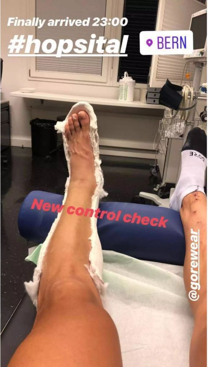 Autsch! Fabian Cancellara zeigt seinen gebrochenen Fuss im Spital in Bern.