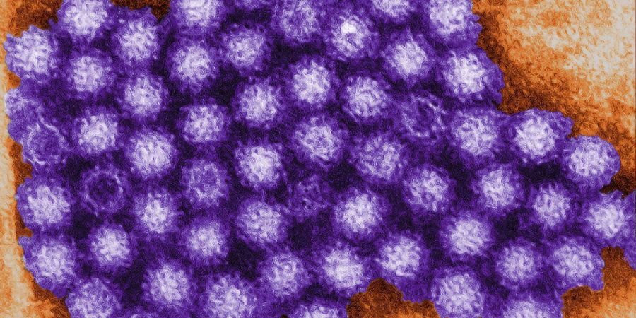 Dieses digital eingefärbte, transmissionselektronenmikroskopische (TEM) Bild zeigt einen Teil der ultrastrukturellen Morphologie eines Clusters von Noroviren.