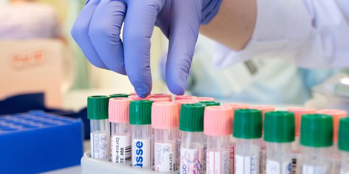 Ständeratskommission : Die Kosten für Laboranalysen sollen weiterhin vom Bund festgelegt werden. (Symbolbild) Labormitarbeiterinnen etikettieren im Medizinischen Labor Ostsachsen Corona-Abstriche zum Virusnachweis mit der PCR-Methode.