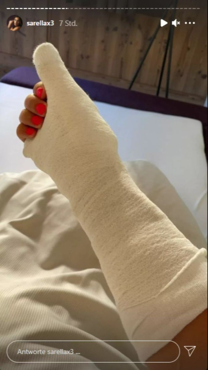 In ihrer Insta-Story zeigt Sarah Engels ihre gebrochene Hand. Sarah Engels